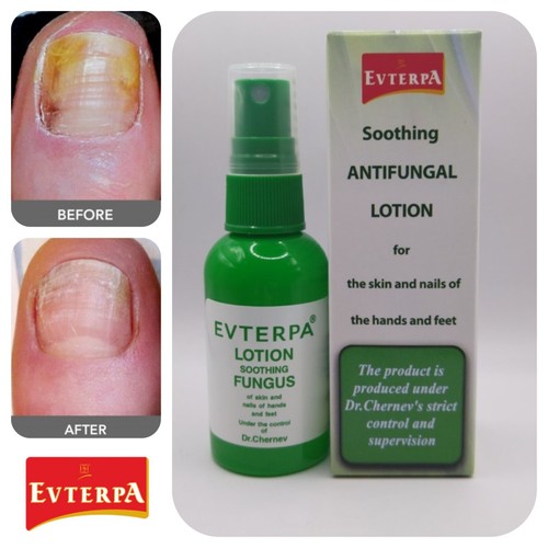 Nagelpilz behandlung anti pilz - anti,