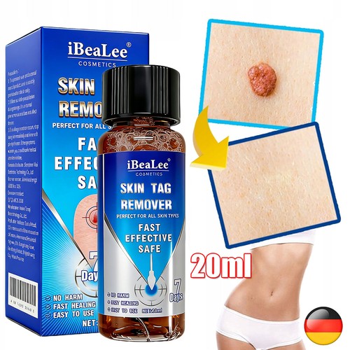 Warzenentferner set skin - set,