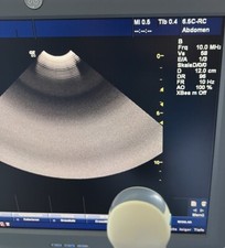 GE Ultraschall Sonde 6,5C-RC MicroConvex Ultrasound Probe für GE Logic C5 C3