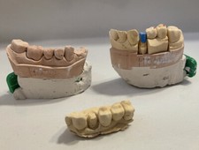 Zahnmodell Unterkiefer