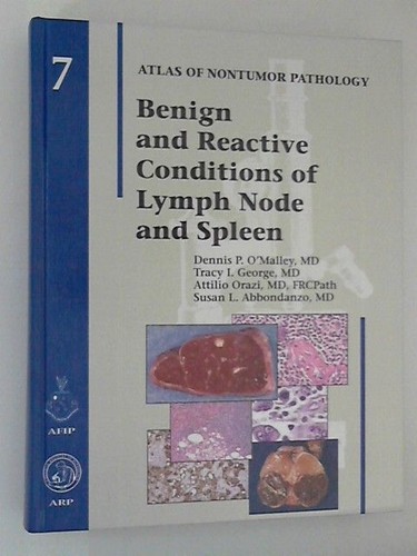 Benign and reactive - and,