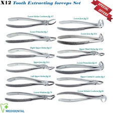 Chirurgisch Zahn Extraktion