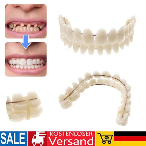 Snap veneers kosmetische - on,