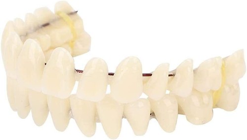Künstliche implantate zähne - kÜnstliche,
