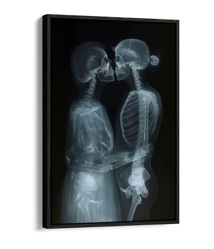 Röntgenbild paar küsst - röntgenbild,