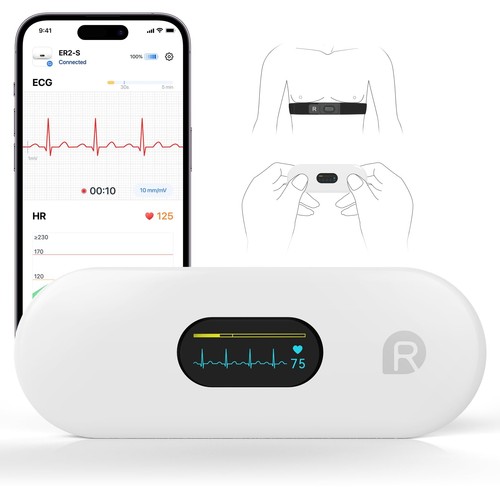 Checkme er2 ekg - checkme, mit