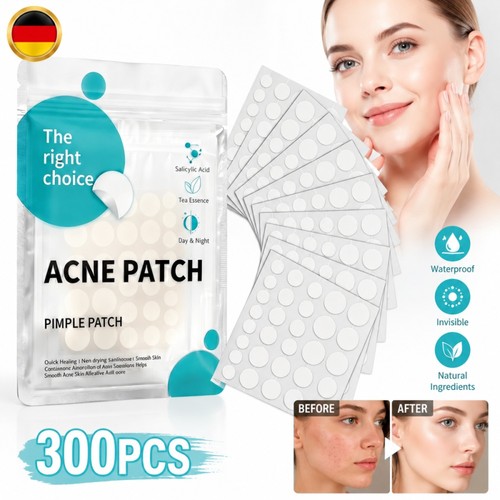 300 stück pickel - 300,