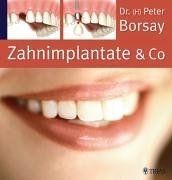 Zahnimplantate die - zahnimplantate, co.