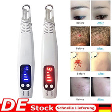 Rot/Blau Licht Laser