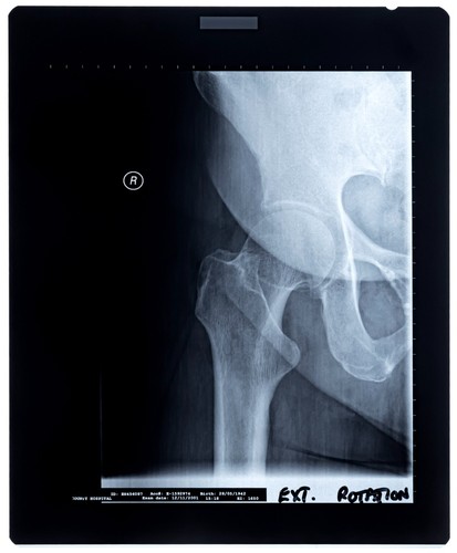 Original krankenhaus - original,