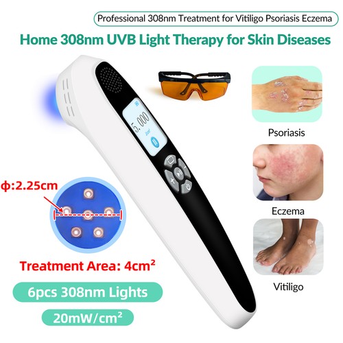 308nm uvb phototherapie - 308nm,