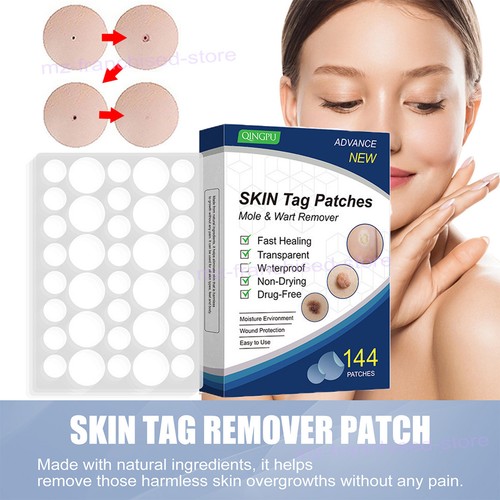 Skin tag removal patches - skin,