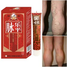 Chinese Krampfadern Behandlung