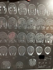 Original Vintage Krankenhaus Mensch Röntgen CT Scan Tomographie Original Acetat Film 4