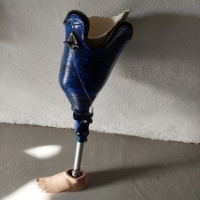 Beinprothese  Kniegelenk