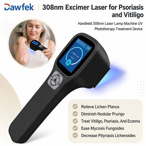 Handheld 308nm uvb light - handheld,