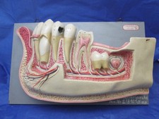Lehrmodell Unterkiefer Zähne