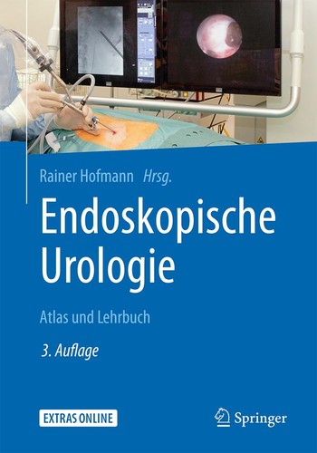 Rainer hofmann endoskopische - hofmann,