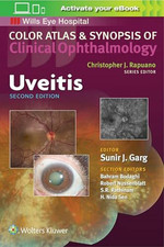 Uveitis (Color Atlas & Synopsis of Buch Lippincott Williams and Wilkins