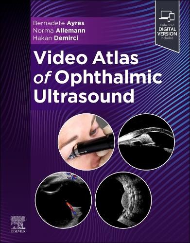 Video atlas ophthalmic - video,