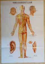 Akupunktur-Poster  Papier /