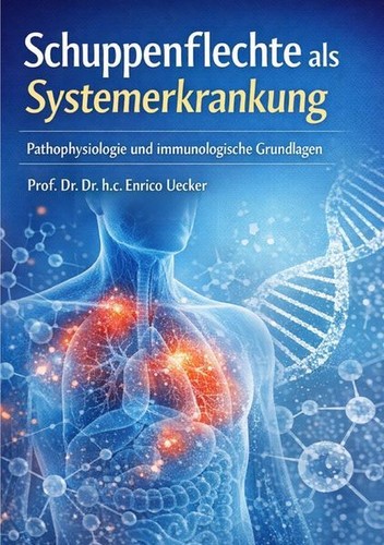 ?Schuppenflechte als