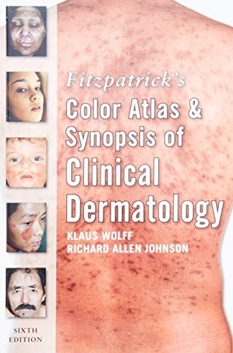 Fitzpatrick color atlas - fitzpatrick's,