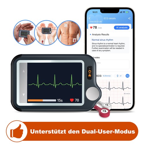 Checkmeex tragbares ekg - checkmeex, ekg-gerät