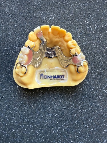 Zahnprothese zahnersatz ok - zahnersatz,,