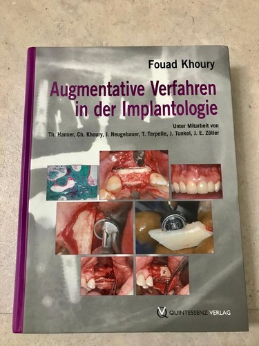 Augmentative verfahren - augmentative,