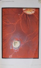 OPHTHALMOLOGIE – BASLER