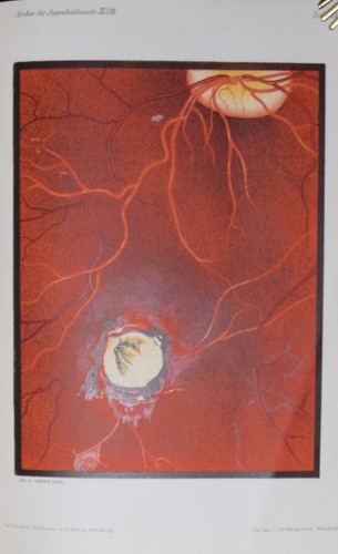 Ophthalmologie basler - –,