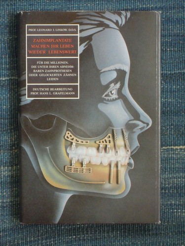 Zahn implantate machen ihr - machen,