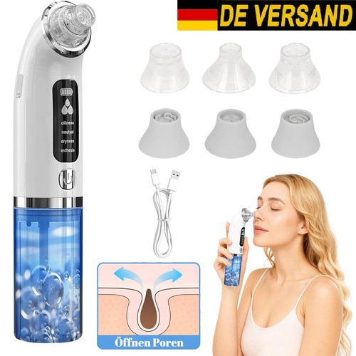 Elektrische mitesser entferner - elektrische,