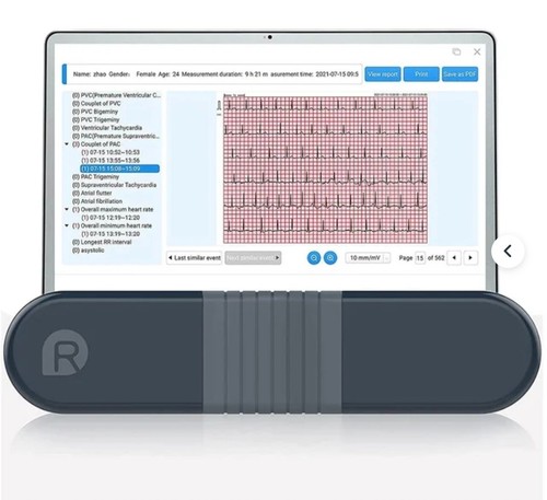 Wellue er1 ekg ecg monitor - ekg,