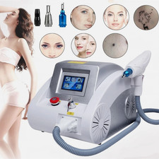 ND Yag Laser Tattooentfernung