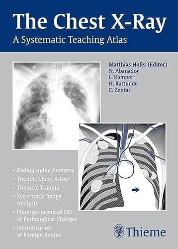 The chest ray a systematic - x-ray:,
