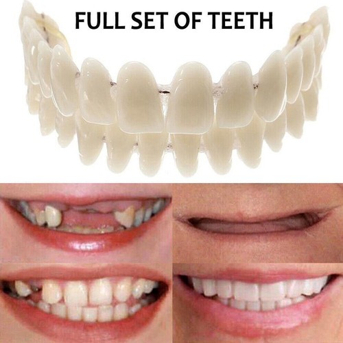 Snap veneers kosmetische - on,