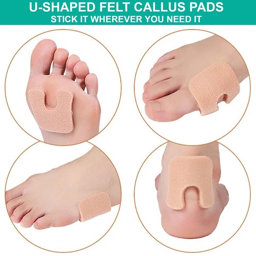 Pedimend u förmige - pedimend™, u-förmige