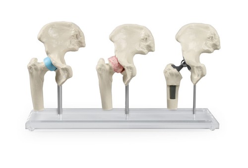 Anatomisches modell hüfte - anatomisches,