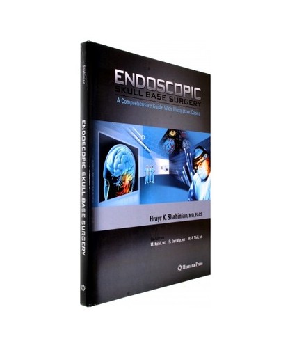 Endoscopic skull base - base, surgery