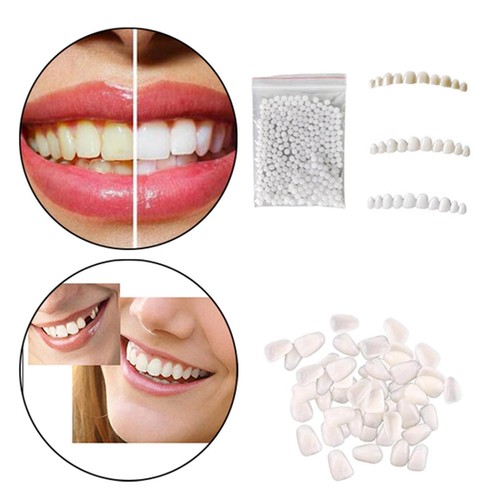 Zahnersatz zahn veneers für - zahnersatz,