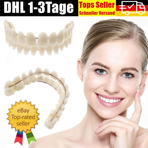 Snap veneers kosmetische - on, -veneers-