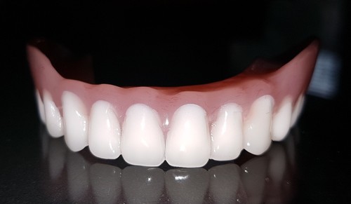 Zahnprothese,dentures,zahnersa