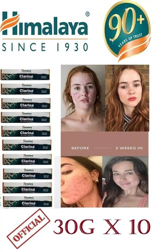 Himalaya clarina anti - clarina, akne