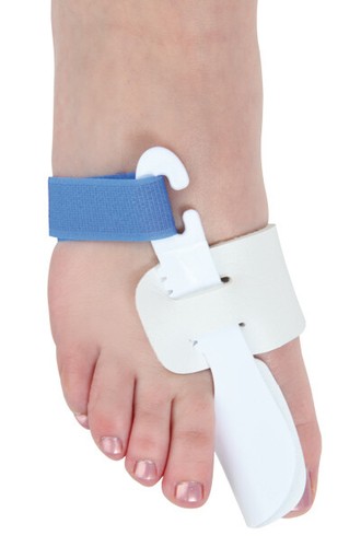 Schiebler hallux valgus - schiebler, hallux-valgus