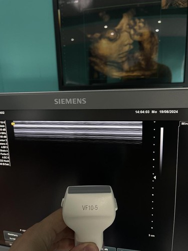 Siemens vf10 linear - siemens, vf10-5