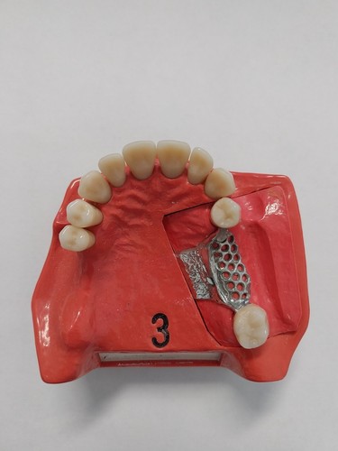 Dent schaumodell 3 mit - schaumodell,