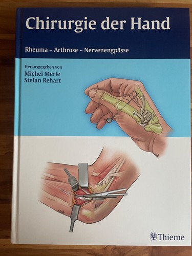 Chirurgie der hand rheuma - der,