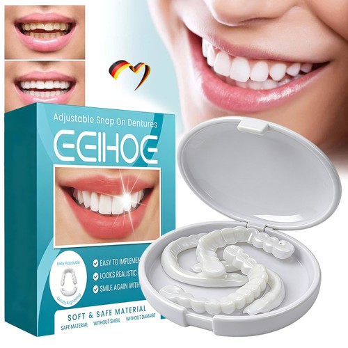 Veneers oben unten falsche